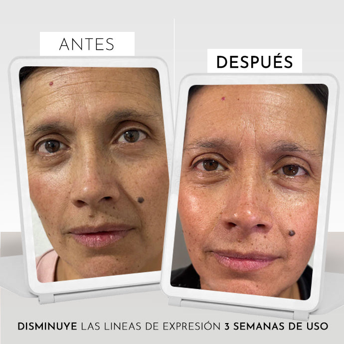 Kit Antiedad o piel seca sensible