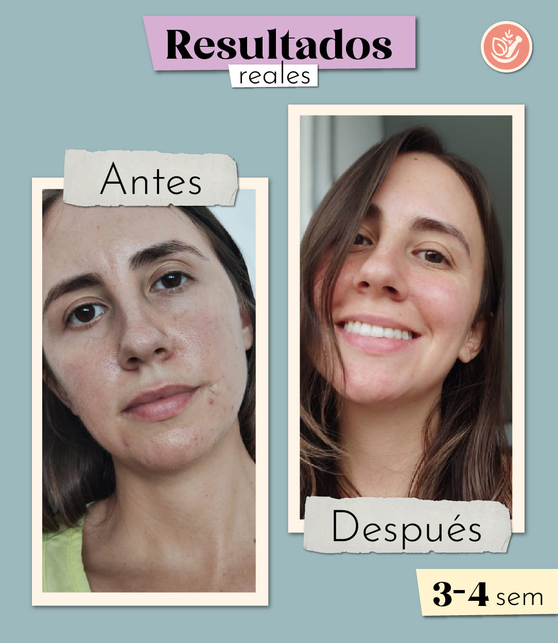 Dúo Protección Solar Antiedad